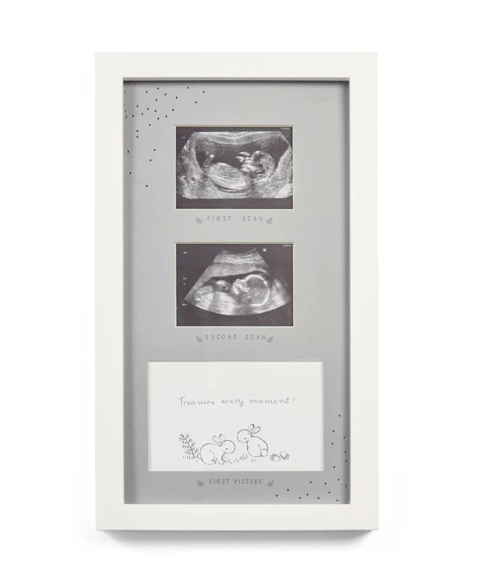 Light gray double photo frame with two ultrasound prints and decorative bottom border