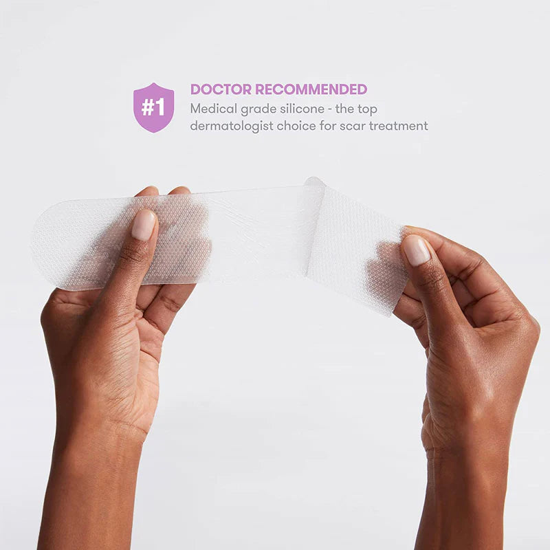 Medical silicone scar patches, two held up by hands on skin