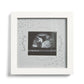White baby scan photo frame with ultrasound print, leaf accents, Forever Treasured text.