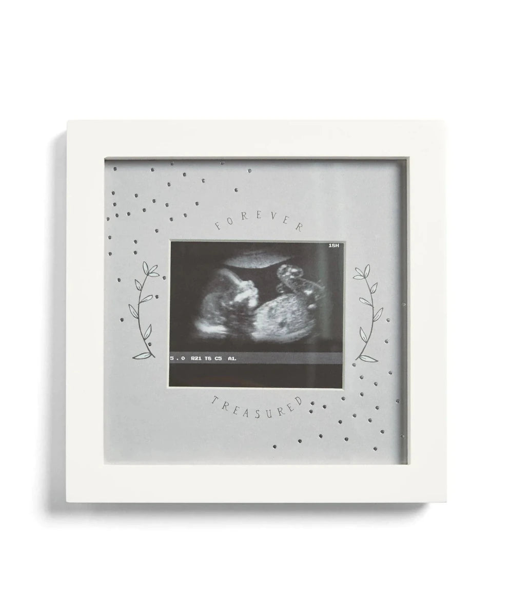 White baby scan photo frame with ultrasound print, leaf accents, Forever Treasured text.